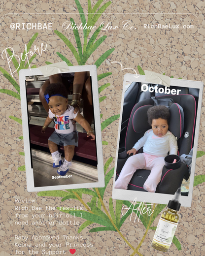 Rosemint Hair Growth